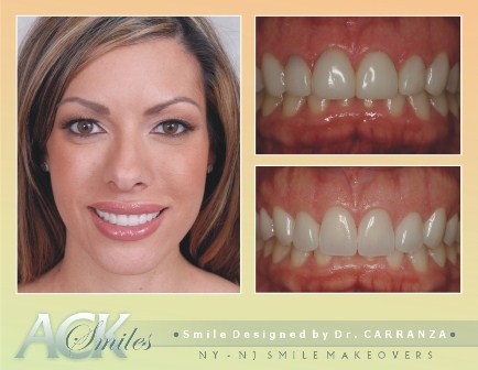 Cosmetic Dentistry NJ
